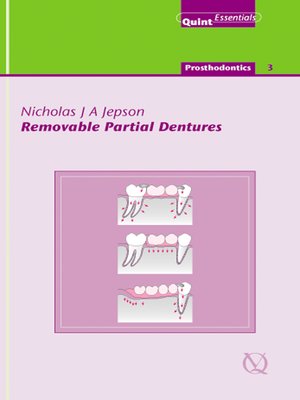 cover image of Removable Partial Dentures